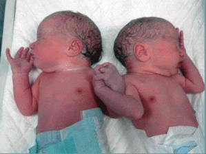 ikiz bebekler-10.gif